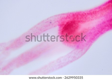 Hydra under microscope showing tentacles and body structure