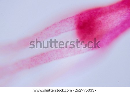 Hydra under microscope showing tentacles and body structure