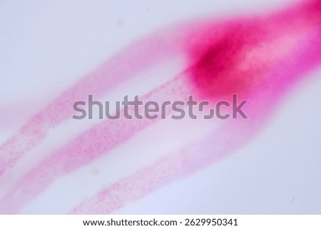 Hydra under microscope showing tentacles and body structure