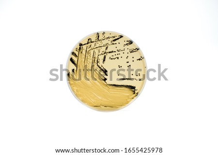 hydrogen sulfide colony or black or H2S colony of gram-negative bacilli or  salmonella on SS or Salmonella Shigella Agar