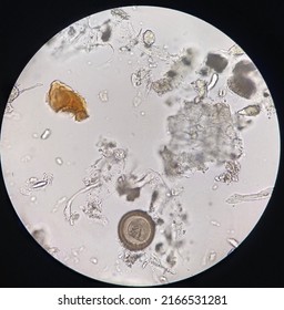 Hymenolepis diminuta egg (40x microscope).Rat tapeworm in stool examination.This parasite infected by cysticercoid.