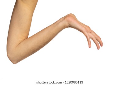 hyperlaxity of the wrist and hand, Marfan, Elher danlos. - Shutterstock ID 1520985113