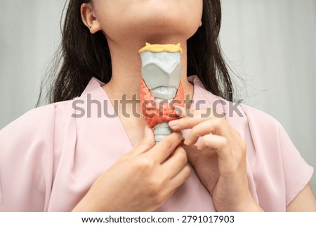 Hyperthyroidism, Overactive Thyroid, Thyroid Lymphoma, Asian woman with thyroid gland human anatomy model.