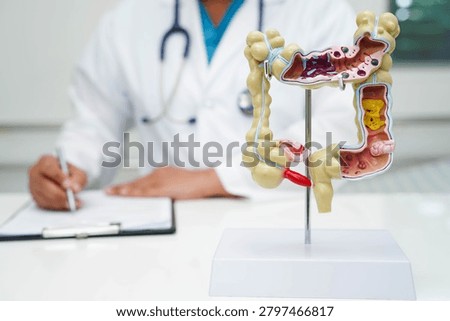 Hyperthyroidism, Overactive Thyroid, Thyroid Lymphoma, Asian woman with thyroid gland human anatomy model.
