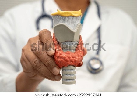 Hyperthyroidism, Overactive Thyroid, Thyroid Lymphoma, Asian doctor with thyroid gland human anatomy model in hospital.