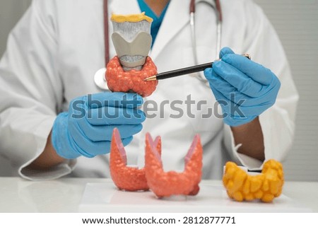 Hyperthyroidism, Overactive Thyroid, Thyroid Lymphoma, Asian doctor with thyroid gland human anatomy model in hospital.
