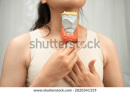 Hyperthyroidism, Overactive Thyroid, Thyroid Lymphoma, Asian woman with thyroid gland human anatomy model.