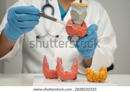 Hyperthyroidism, Overactive Thyroid, Thyroid Lymphoma, Asian doctor with thyroid gland human anatomy model in hospital.