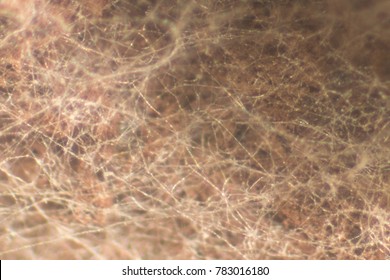 Hyphae Images, Stock Photos & Vectors | Shutterstock