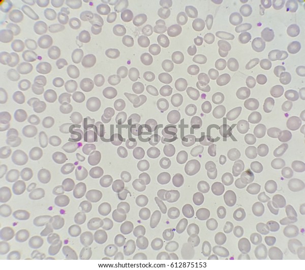 hematologyoutlines-atlas