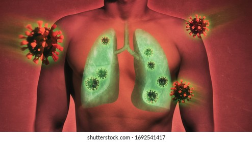 Illustrative Image Of Lung Damage By Coronavirus Covid-19. Human Anatomy. Concept