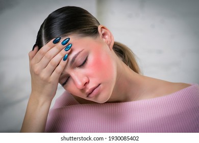 Mlada lijepa bolesna žena pati od vrućine, visoke temperature, glavobolje i migrene, drži ruku na čelu. Simptomi korona virusa, covid-19. Opasne opekotine od sunca. Crveno lice, rumenilo.
