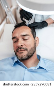 Przystojny mężczyzna w średnim wieku otrzymuje zaawansowaną terapię Platelet Rich Plasma PRP przeciwko wypadaniu włosów. Nowoczesne zabiegi estetyczne dla mężczyzn. Koncepcja opieki zdrowotnej i urody.