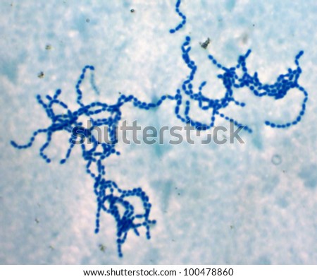 Bacterial cells chains "Streptococcus pyogenes" (Photo from microscope, magnification x 1000). This rare strain have strong anticancer and immunostimulating activity and non-pathogenic Royalty-Free Stock Photo #100478860