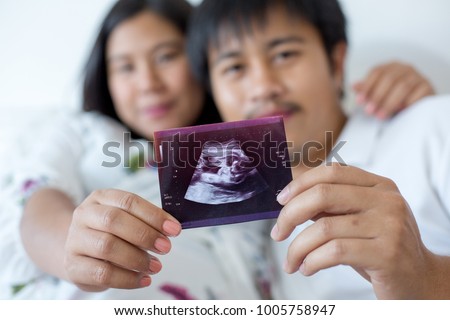 Pregnant women Ultrasound film of her baby with her lover. pregnant women view ultrasound film