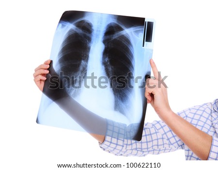 A picture of lungs x-ray over white background