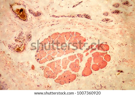 skin of human (show sweat gland) microscopy photo Royalty-Free Stock Photo #1007360920