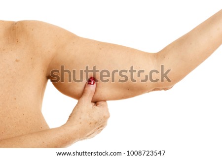 Picture of obese adult woman showing arm over white background