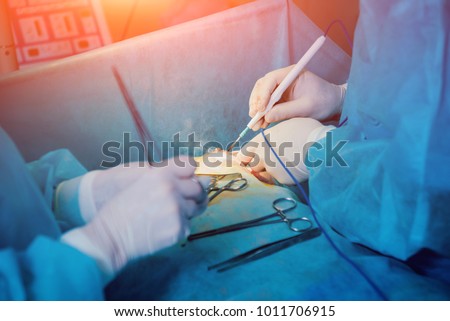 Breast surgery in the operating room. Hospital