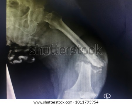 X-ray left leg show bone fracture at femur with space for your text and design. Concept be used for present part of bone fracture and organ for medical and hospital. Blur picture with grain film.