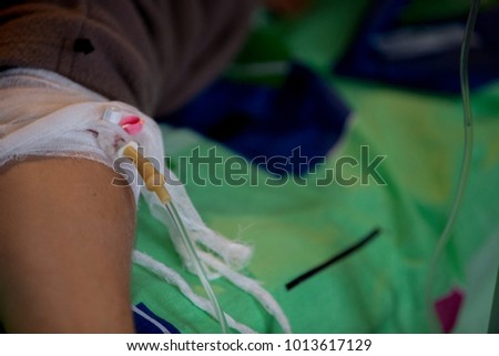 catheter for a dropper in a patient's hand in a hospital