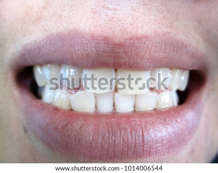 Women smile and see teeth white