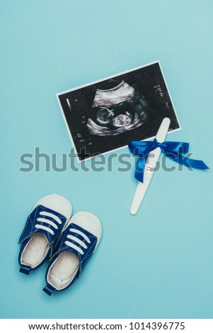 top view of arrangement of childish shoes, ultrasound scan and pregnancy test with ribbon isolated on blue