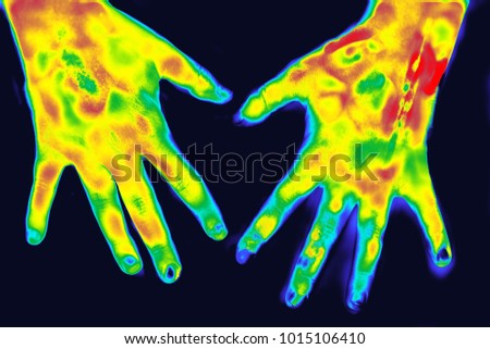 Thermography in medicine. Hands closeup Royalty-Free Stock Photo #1015106410