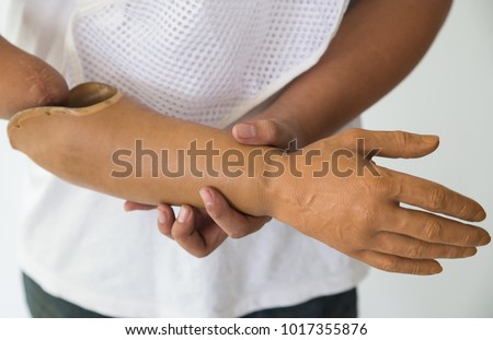 Close-up photos of Hands holding artificial arms.