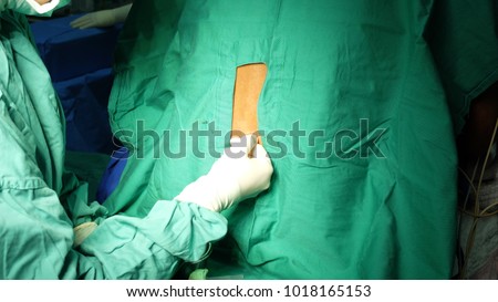 Performing Spinal Anaesthesia via Lumbar Puncture with patient sitting upright and the anaesthetist injecting Local Anaesthetic agent. Step by step procedures.