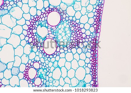 Cross-section Plant Stem typical Monocot and Dicot under the microscope for classroom education. Royalty-Free Stock Photo #1018293823