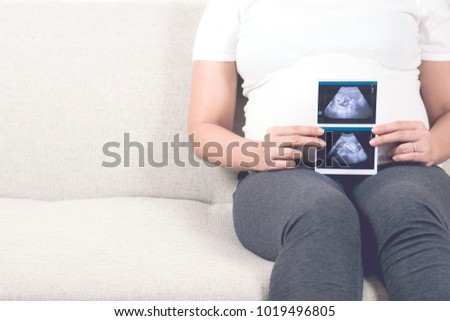 Cropped image of happy pregnant woman sitting on sofa at home holding and showing ultrasound scan photos of her baby to you. Pregnancy healthcare, parent and love concept with copy space.
