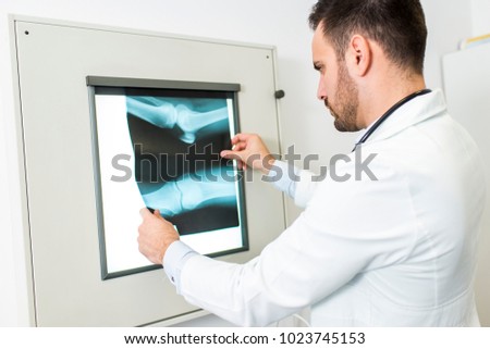 Young doctor analyzes the X-ray image at hospital