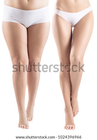 Woman legs before and after slimming.