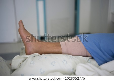 Patient after surgery knee sleep on the bed health and medical concept