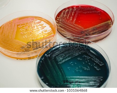 THIOSULPHATE-CITRATE-BILE-SALTS-SUCROSE-AGAR Stock Photos and Images ...