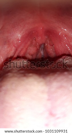Throat and larynx with vocal cords Royalty-Free Stock Photo #1031109931