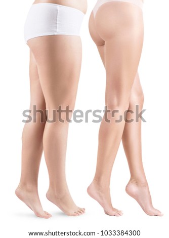 Side view on woman's legs before and after slimming.