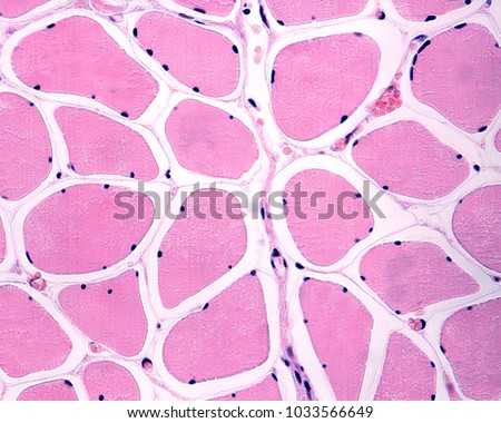 Skeletal striated muscle fibers in cross section showing several peripheral nuclei (multinucleated cells). The endomysium, containing capillaries, appear as thin lines surrounding the muscle fibers.  Royalty-Free Stock Photo #1033566649