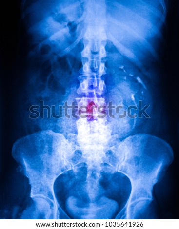 Xray of stomach and pelvis section