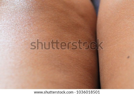 Middle women have cellulite of leg