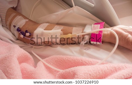 Close up of a patient's hand with Total Parenteral Nutrition (TPN) being administered into vein Royalty-Free Stock Photo #1037226910