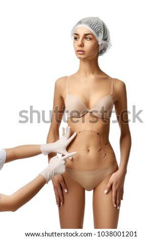 Female body with the drawing arrows on tummy for plastic surgery  liposuction isolated on white. Fat lose and cellulite removal concept