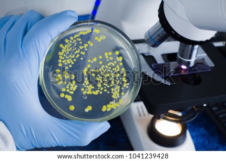 Close-up of a scientist's hand holding a petri dish against a microscope background. Laboratory microscope. Analysis of bacterial culture under a microscope. Study of bacteria under a microscope. Royalty-Free Stock Photo #1041239428
