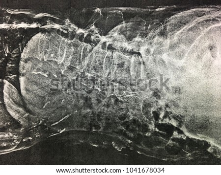 X-ray image of patient.