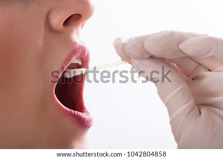 Dentist's Hand Taking Saliva Test From Woman's Mouth With Cotton Swab