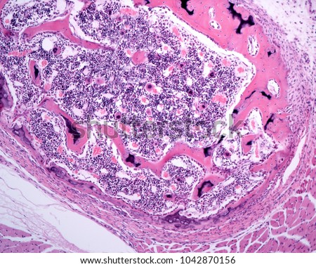 The periosteum surrounds the cortical of immature or primary woven bone tissue (showing remains of cartilage). The intensely stained material of the center is the bone marrow. Royalty-Free Stock Photo #1042870156