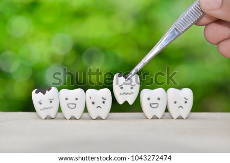 Dentist use tweezers to set of decayed tooth model for dental health care concept
