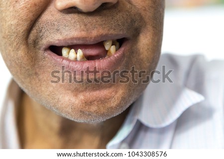 smile of toothless old man  Royalty-Free Stock Photo #1043308576