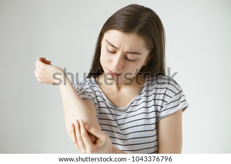 Studio picture of frustrated young dark haired female studying skin on her arm after she fell off bike. Student girl dressed in stylish striped t-shirt looking at her elbow, feeling itch or pain